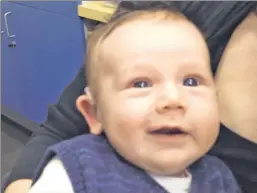  ??  ?? Hear, hear! Medical devices like the hearing aid given to 7-week-old Lachlan — the star of a popular YouTube video — are cause to rejoice.