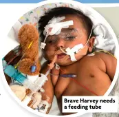  ?? ?? Brave Harvey needs a feeding tube