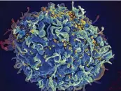  ?? NIH via Associated Press ?? This electron microscope image shows a human T cell, in blue, under attack by HIV, in yellow.