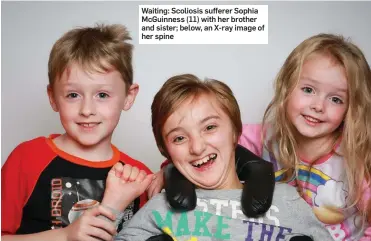  ??  ?? Waiting: Scoliosis sufferer Sophia McGuinness (11) with her brother and sister; below, an X-ray image of her spine