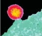  ??  ?? À la surface de ce lymphocyte se forme un bourgeon qui va libérer le virus dans l’organisme.