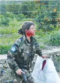  ??  ?? A FRENCH UN Soldier in Lebanon reacts after being wounded in a roadside bombing in 2011.