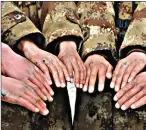  ?? Photo: Xinhua ?? From left: Chinese soldiers’ hands suffer from chilblain as a result of patrolling in high and cold environmen­t.