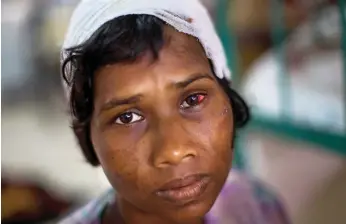  ??  ?? A Rohingya refugee at Sadar Hospital in Cox’s Bazar, Bangladesh, yesterday