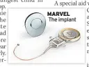  ??  ?? MARVEL The implant