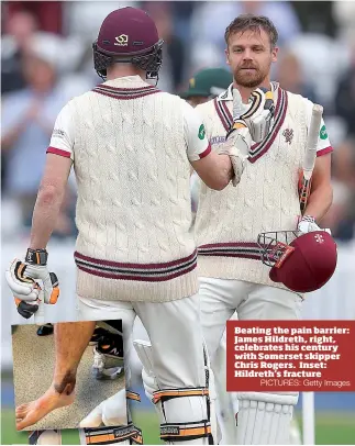  ?? PICTURES: Getty Images ?? Beating the pain barrier: James Hildreth, right, celebrates his century with Somerset skipper Chris Rogers. Inset: Hildreth’s fracture