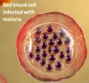  ?? ?? Red blood cell infected with malaria