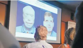  ?? Picture / AP ?? Patrick Hardison watches a video that shows the progressio­n of his face transplant.