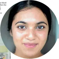  ??  ?? Meghna Narayan, 17, of Papatoetoe, received bone tissue from the bone bank during an operation to treat a cyst in her hip bone.