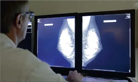  ?? Picture: REUTERS ?? POSSIBLE RELIEF: A radiologis­t examines breast X-Rays after a regular cancer prevention medical check-up.