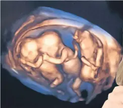  ??  ?? Doting Mary pictured with a 3D scan of the triplets in the womb