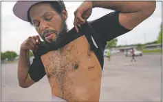  ??  ?? Demetrius Poindexter, 40, of St. Louis lifts his shirt to show a bullet hole scar. Poindexter says he was shot during a drug deal gone bad.