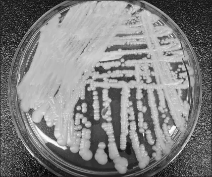  ?? SHAWN LOCKHART / CENTERS FOR DISEASE CONTROL AND PREVENTION VIA AP ?? This undated photo made available shows a strain of Candida auris cultured in a petri dish at a CDC laboratory. The agency said this month that Candida auris it is becoming a more dangerous threat to public health and warned health care facilities to be on the lookout for the fungus in their patients.