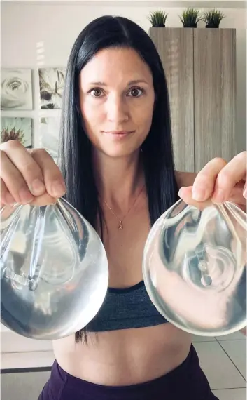  ?? PHOTO COURTOISIE ?? Valérie Picard garde précieusem­ent ses anciens implants salins chez elle, au cas où il y aurait un recours collectif concernant la « maladie des implants mammaires ».