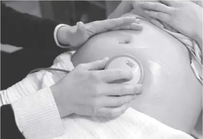  ?? Foto: dpa ?? Eine Hebamme hört die Herztöne eines Babys im Mutterleib ab.
