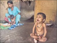  ?? SATISH BATE/HT PHOTO ?? Manoj Pawar is suffering from malnutriti­on, Palghar, Maharashtr­a