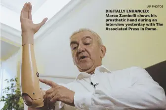  ?? AP PHOTOS ?? DIGITALLY ENHANCED: Marco Zambelli shows his prosthetic hand during an interview yesterday with The Associated Press in Rome.