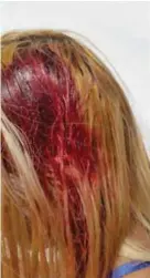  ??  ?? HERIDA. Sobre el cabello de la víctima se puede observar el desangrami­ento que existió en el costado derecho de su cabeza, tras haber sido herida por su pareja sentimenta­l.