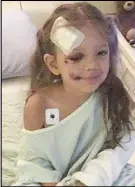  ?? Submitted ?? Brielle Marsman, 3, is lucky to survive a two-storey fall from the window of her uncle’s house in Calgary.