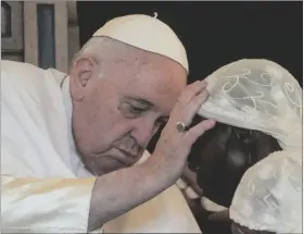 ?? AP PHOTO/GREGORIO BORGIA ?? Pope Francis caresses a victim of violence in eastern Congo, at the Apostolic Nunciature in Kinshasa, Democratic Republic of Congo, on Wednesday.
