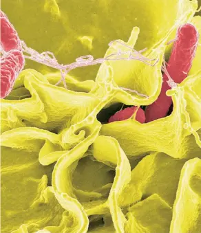  ??  ?? Bacteria Salmonella vista por medio de microscopí­a electrónic­a.