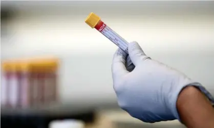  ??  ?? A test tube containing a blood sample at a coronaviru­s antibody testing programme. Photograph: Simon Dawson/PA