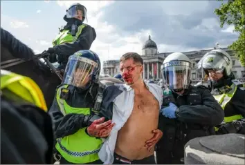  ?? Dan Kitwood/Getty Images ?? Police lead an injured man away from clashes between protesters Saturday in Trafalgar Square in central London.