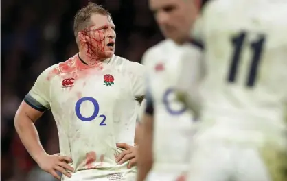  ??  ?? Dylan Hartley says players ‘gobble painkiller­s like Smarties … senior players have bits falling off them’. Photograph: Tom Jenkins/The Guardian