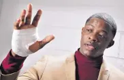  ?? LARRY MCCORMACK/THE TENNESSEAN ?? James Shaw Jr. shows his hand that was injured when he disarmed a shooter inside a Waffle House on Sunday in Nashville, Tenn.