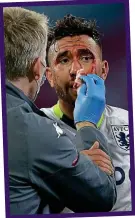  ?? KEVIN QUIGLEY ?? In the wars: Trezeguet has treatment after getting a stud in the face