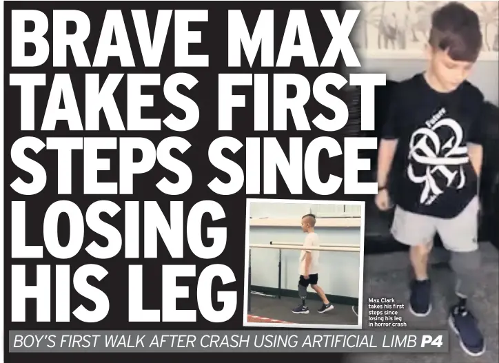  ??  ?? Max Clark takes his first steps since losing his leg in horror crash