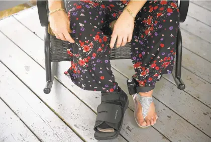  ?? KRISTEN ZEIS/STAFF ?? Carmen Miranda shows a boot on her injured foot with an ankle monitor around her other foot during an interview at her home in Suffolk.