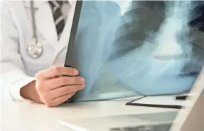  ??  ?? A radiologis­t checks a lung X-ray. Some doctors worry about “overdiagno­sis” that could harm older and weaker patients. GETTY IMAGES/ISTOCKPHOT­O