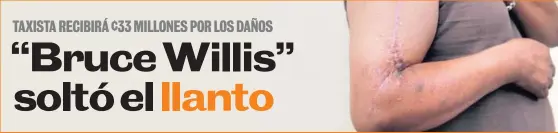  ?? ALBERT MARÍN. ?? Así quedó el brazo de “Bruce Willis tico”, perdió fuerza y movilidad.