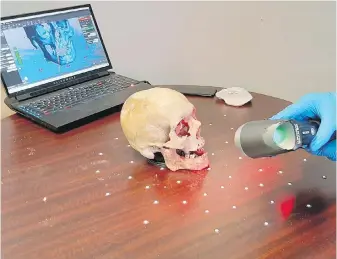  ??  ?? A skull is scanned by a technician from the National Research Council to create 3D printings using powdered, laser-melted nylon. Technician­s will use clay to resconstru­ct the face.