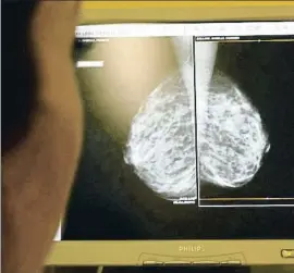  ?? ERIC GAILLARD / REUTERS ?? Un médico examina una mamografía