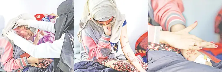  ?? — AFP photos ?? Combinatio­n pictures shows Al-Anoud Hussain Sheryan disfigured in an acid a ack by her abusive husband.