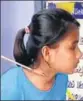  ?? YOUTUBE ?? Fazila Khatun with an arrow stuck in her neck.