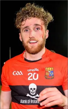  ??  ?? Bloodied but unbowed....Ross Donohoe of Buffers Alley, Wexford and U.C.C. after the final whistle.