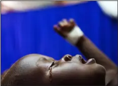  ?? ALBERT GONZALEZ FARRAN — AFP VIA GETTY IMAGES ?? A child with severe malnutriti­on cries at a clinic run by Doctors Without Borders (MSF) in Aweil, Northern Bahr al Ghazal, South Sudan in 2017.