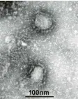  ?? Foto: IVDC ?? Das Coronaviru­s hat seinen Namen wegen seiner „Krone“.