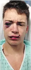  ?? MATHIEU GRÉGOIRE ?? Mathieu Grégoire posted a picture of himself on social media after he says he was hit with a beer bottle at Festival Western de St-Tite Friday.