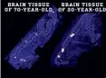  ??  ?? Scientists see just as much evidence of new nerve cells (dots) in elderly as in young people.