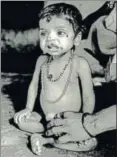  ?? SATISH BATE/HT PHOTO ?? Every third malnourish­ed child in the world is Indian. Every third child in India is malnourish­ed