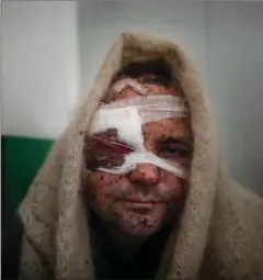 ?? FOTO: EVGENIY MALOLETKA/AP ?? Såret mand fotografer­et under Maloletkas 20 dage i Mariupol, mens russerne stod for døren.