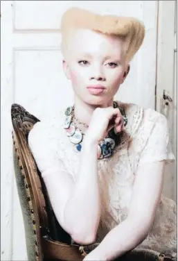  ??  ?? REVOLUTION­ARY: Model and lawyer Thando Hopa is fighting for equal rights for those affected by albinism.