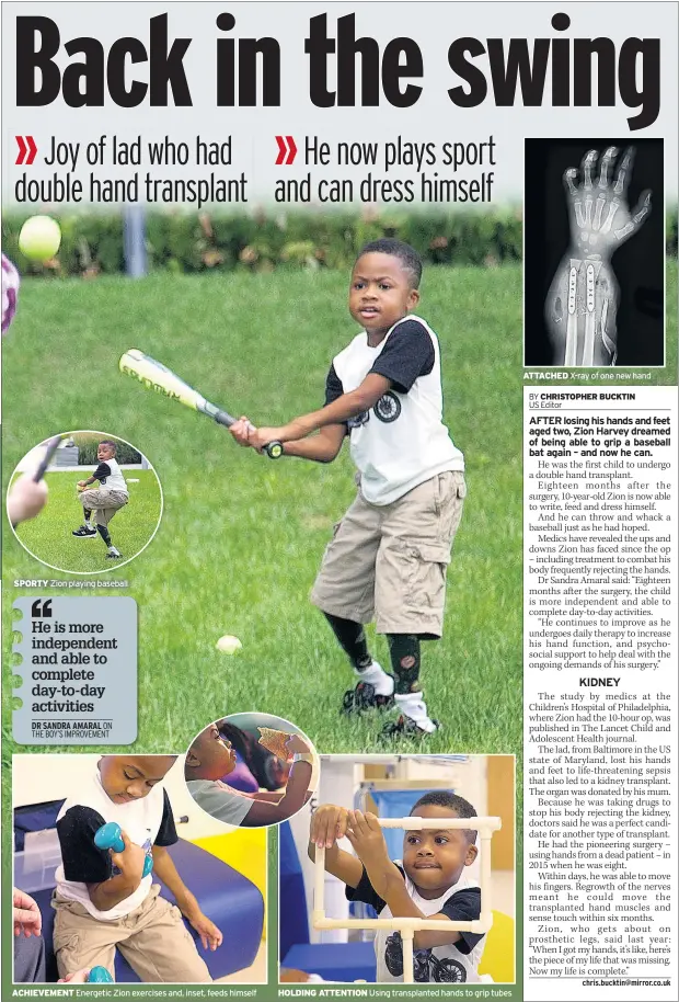  ??  ?? SPORTY Zion playing baseball ACHIEVEMEN­T Energetic Zion exercises and, inset, feeds himself HOLDING ATTENTION Using transplant­ed hands to grip tubes ATTACHED X-ray of one new hand