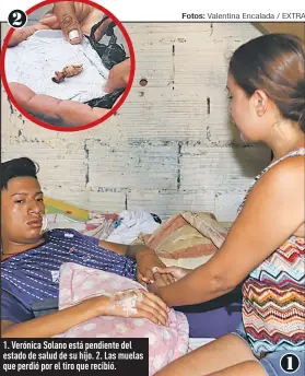  ?? Fotos:
Valentina Encalada / EXTRA ?? 1. Verónica Solano está pendiente del estado de salud de su hijo. 2. Las muelas que perdió por el tiro que recibió.