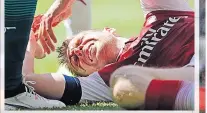  ??  ?? DESPAIR FOR PER Arsenal’s Mertesacke­r was badly hurt