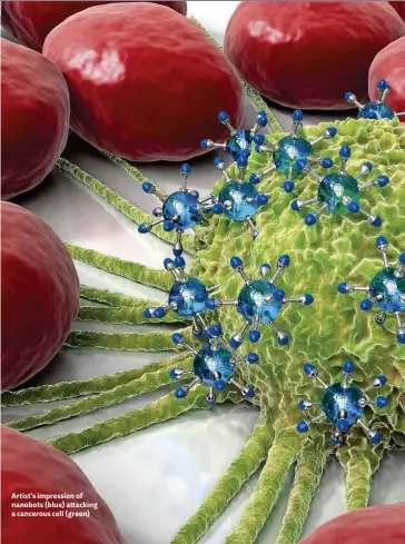  ??  ?? Artist’s impression of nanobots (blue) attacking a cancerous cell ( green)